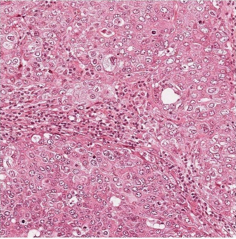 histo stained tissue