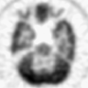 hoffman struct SR4 compliment